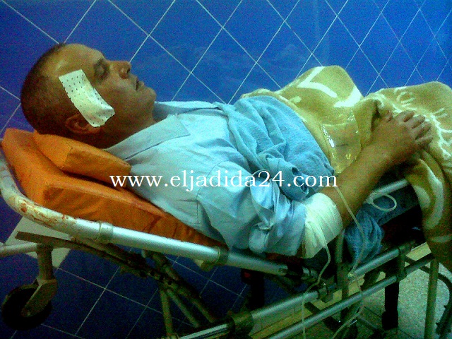إصابة رجل أمن بطلقة في رأسه بمهرجان التبوريدة بسيدي بنور