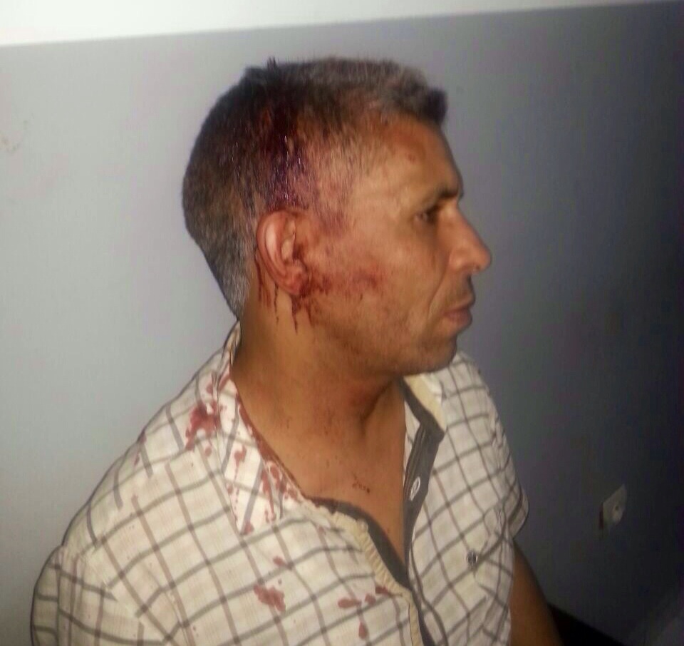 الزميل الصحفي عبد الرحمن بنصفية يتعرض الى اعتداء شنيع من طرف 4 مجهولين على متن سيارة مرقمة بالخارج
