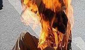 بسبب أضحية العيد.. شاب يضرم النار في جسده بالجديدة