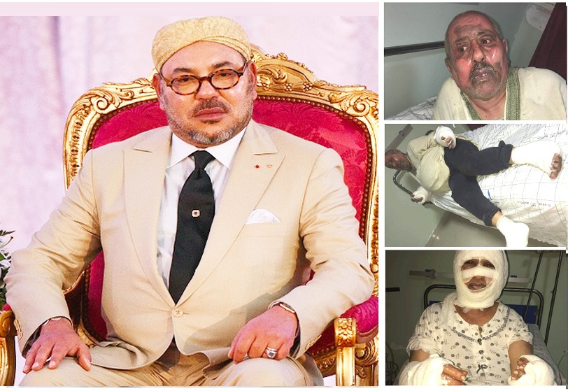 الفنان مصطفى الجلبي يناشد الملك.. بعد أن التهمته وزوجته النيران في انفجار قنينة غاز بالجديدة