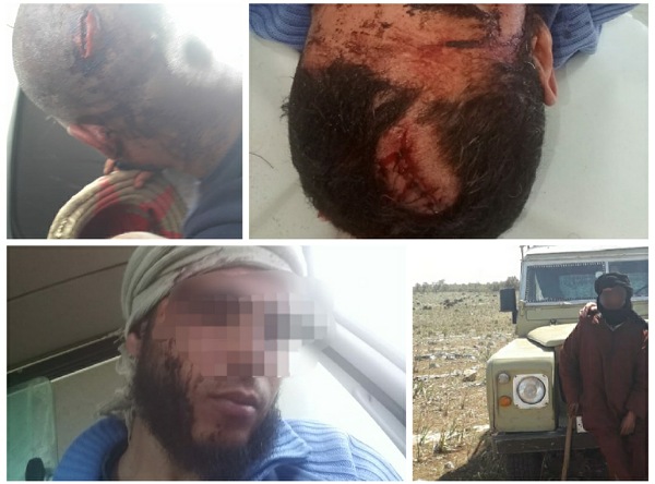 رعاة رحل من الصحراء يعتدون على مواطنين بجماعة اولاد عيسى ويرسلونهم الى قسم المستعجلات بمستشفى الجديدة 
