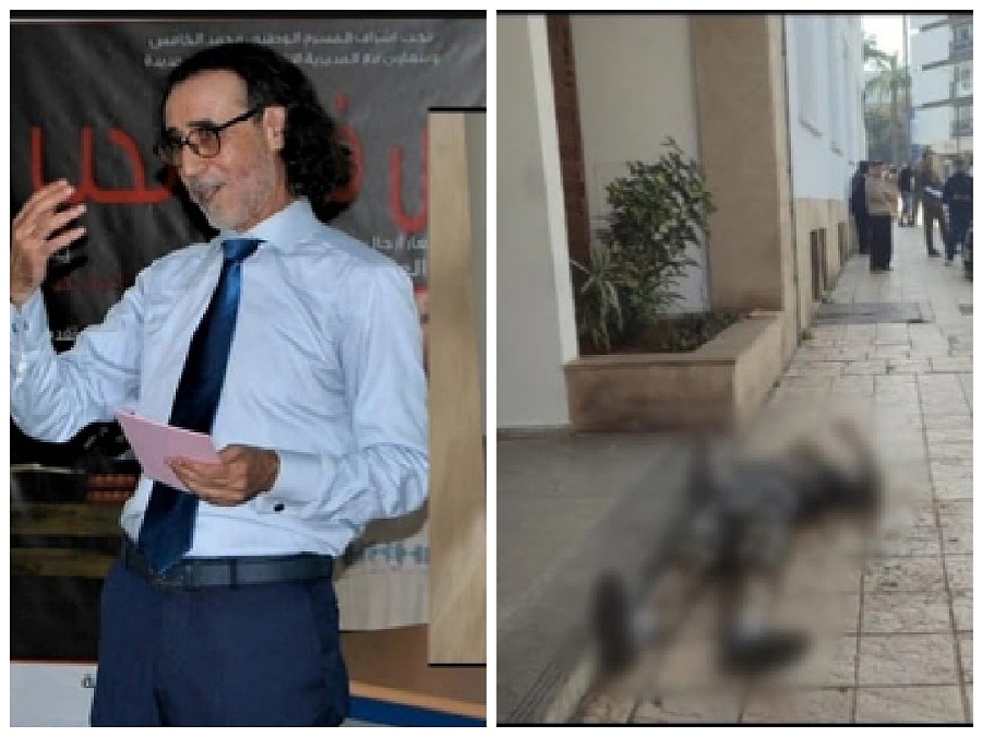 الفنان المسرحي أحمد جواد  إبن مدينة الجديدة يحرق نفسه احتجاجا على تقاعده الهزيل 