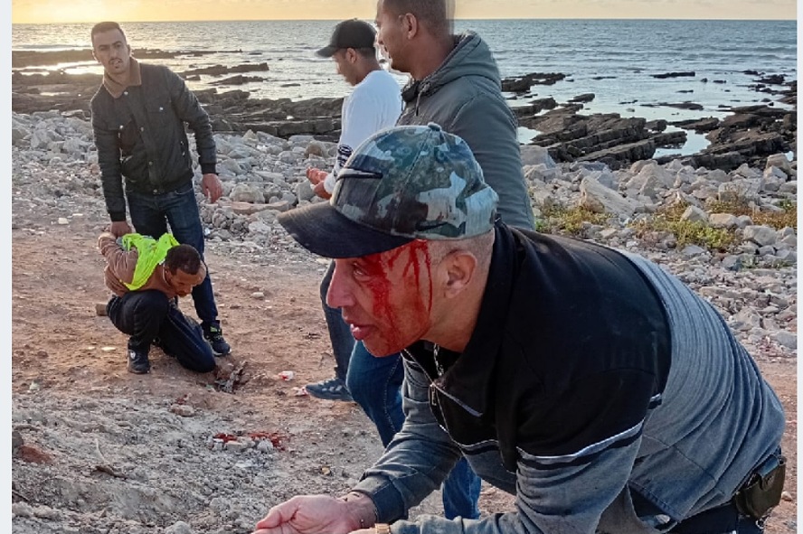 اعتداء على عنصر أمني بالجديدة من طرف شخص يرتدي 'جيلي أصفر' بشارع النصرمقبرة الرحمة بالجديدة بدون ماء.. معاناة يومية وصمت الجهات المعنيةمطالب بإحداث 'بيت الصحافة' بالجديدة بمناسبة اليوم العالمي لحرية الصحافةهل يتدخل عامل الجديدة لفتح هذا الشارع المهم في وجه السيارات ؟دار الطالب بأولاد حمدان تحتضن بطولة مؤسسات الرعاية الاجتماعيةالعثور على جثة شخص داخل منزل بشارع الزرقطوني بعد اختفائه لثلاثة أيام  .إدانة امين مال  جمعية رياضية بالجديدة بـ8 سنوات سجنا بتهمة هتك عرض قاصر.موظفو السجن المحلي الجديدة 2يخلدون الذكرى17لتأسيس المندوبية العامة بحضور عامل الإقليم  .حمزة رويجع يكشف تطورات مسار قضائي ويؤكد المغرب دولة مؤسسات لا تخضع للابتزاز الرقميفؤاد مسكوت يكتسح انتخابات الاتحاد الإفريقي للمصارعة المرتبة الأولى  - الجديدة 24